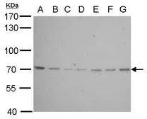 Anti-Lamin B2 antibody [N3C2], Internal used in Western Blot (WB). GTX109894