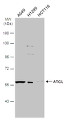 Anti-ATGL antibody [N1C1] used in Western Blot (WB). GTX109941