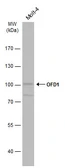 Anti-OFD1 antibody used in Western Blot (WB). GTX110010