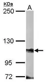 Anti-FOG2 antibody used in Western Blot (WB). GTX110166