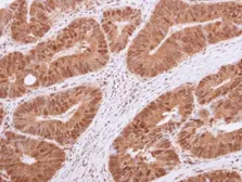 Anti-HDAC4 antibody [N3C1], Internal used in IHC (Paraffin sections) (IHC-P). GTX110231