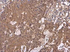Anti-Hepatic lipase antibody [N1C1] used in IHC (Paraffin sections) (IHC-P). GTX110336