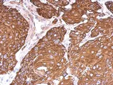 Anti-Cytokeratin 6 antibody used in IHC (Paraffin sections) (IHC-P). GTX110426