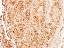 Anti-alpha Tubulin 8 antibody [N1C1-2] used in IHC (Paraffin sections) (IHC-P). GTX110432