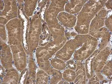 Anti-FRAT1 antibody [C2C3], C-term used in IHC (Paraffin sections) (IHC-P). GTX110492