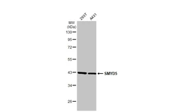 Anti-SMYD5 antibody [C2C3], C-term used in Western Blot (WB). GTX110518