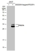 Anti-PDGFA antibody used in Western Blot (WB). GTX110647