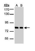 Anti-Hec1 antibody used in Western Blot (WB). GTX110735