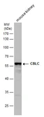 Anti-CBLC antibody [N1C2] used in Western Blot (WB). GTX110775