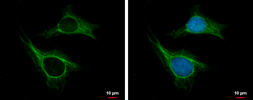 Anti-CKAP2 antibody used in Immunocytochemistry/ Immunofluorescence (ICC/IF). GTX110830
