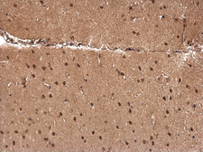 Anti-CCAR1 antibody used in IHC (Paraffin sections) (IHC-P). GTX110892