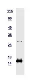 Human Alpha Lactalbumin protein, His tag. GTX110982-pro
