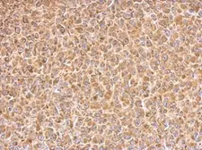 Anti-PAK1 antibody [N2C2], Internal used in IHC (Paraffin sections) (IHC-P). GTX111076