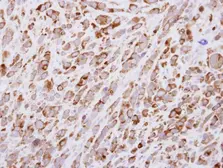 Anti-EGF antibody [C2C3], C-term used in IHC (Paraffin sections) (IHC-P). GTX111176