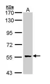 Anti-GCM2 antibody [N3C3] used in Western Blot (WB). GTX111206