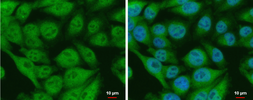 Anti-CIAPIN1 antibody used in Immunocytochemistry/ Immunofluorescence (ICC/IF). GTX111212