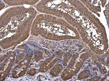 Anti-HKDC1 antibody used in IHC (Paraffin sections) (IHC-P). GTX111506