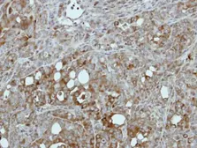 Anti-Pyruvate Kinase (liver/RBC) antibody used in IHC (Paraffin sections) (IHC-P). GTX111536
