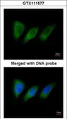 Anti-PKN2 antibody [N1N3] used in Immunocytochemistry/ Immunofluorescence (ICC/IF). GTX111577
