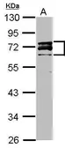 Anti-Lamin A + C antibody used in Western Blot (WB). GTX111677