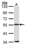 Anti-Septin 11 antibody [N1C1] used in Western Blot (WB). GTX112103