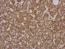 Anti-SH2D3C antibody [C2C3], C-term used in IHC (Paraffin sections) (IHC-P). GTX112162