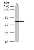 Anti-SAH3 antibody [N3C3] used in Western Blot (WB). GTX112212