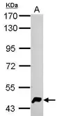 Anti-HERPUD1 antibody used in Western Blot (WB). GTX112261