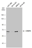 Anti-CRMP5 antibody [N1C1] used in Western Blot (WB). GTX112287