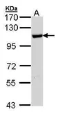Anti-HSPA4 antibody [N1N3] used in Western Blot (WB). GTX112329