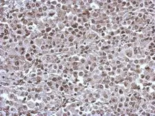 Anti-KIF22 antibody [N3C2], Internal used in IHC (Paraffin sections) (IHC-P). GTX112357