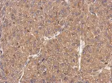 Anti-FMNL1 antibody [C1C2], Internal used in IHC (Paraffin sections) (IHC-P). GTX112404
