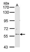 Anti-RCBTB2 antibody [N3C3] used in Western Blot (WB). GTX112492