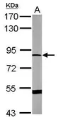 Anti-DRP2 antibody [N3C1], Internal used in Western Blot (WB). GTX112512