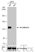 Anti-N-Cadherin antibody [N1N3] used in Western Blot (WB). GTX112734