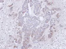 Anti-CD272 antibody used in IHC (Paraffin sections) (IHC-P). GTX112783
