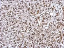 Anti-FLI1 antibody used in IHC (Paraffin sections) (IHC-P). GTX112937