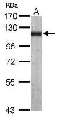 Anti-alpha Actinin 4 antibody [N2C1], Internal used in Western Blot (WB). GTX113115