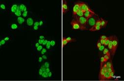 Anti-GATA4 antibody used in Immunocytochemistry/ Immunofluorescence (ICC/IF). GTX113194