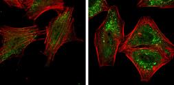 Anti-ATG5 antibody used in Immunocytochemistry/ Immunofluorescence (ICC/IF). GTX113309