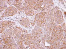 Anti-CARD11 antibody [N1N2], N-term used in IHC (Paraffin sections) (IHC-P). GTX113328