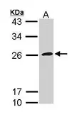 Anti-CD42c antibody [N2C2], Internal used in Western Blot (WB). GTX113355