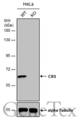 Anti-CBS antibody used in Western Blot (WB). GTX113400