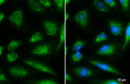 Anti-DBT antibody used in Immunocytochemistry/ Immunofluorescence (ICC/IF). GTX113412