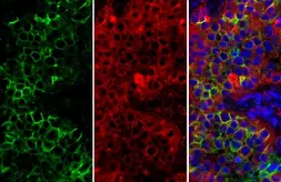 Anti-CD73 antibody [N1N3] used in IHC (Paraffin sections) (IHC-P). GTX113509