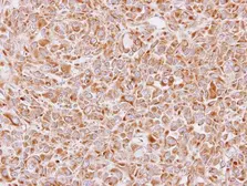 Anti-14-3-3 epsilon antibody [N2C3] used in IHC (Paraffin sections) (IHC-P). GTX113576