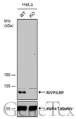 Anti-MVP/LRP antibody used in Western Blot (WB). GTX113601