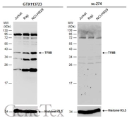 Anti-TFIIB antibody [N2C3] used in Western Blot (WB). GTX113723