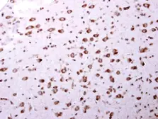Anti-ARA9 antibody used in IHC (Paraffin sections) (IHC-P). GTX113891