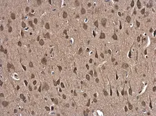 Anti-Glutathione Reductase antibody [N2C2], Internal used in IHC (Paraffin sections) (IHC-P). GTX114199